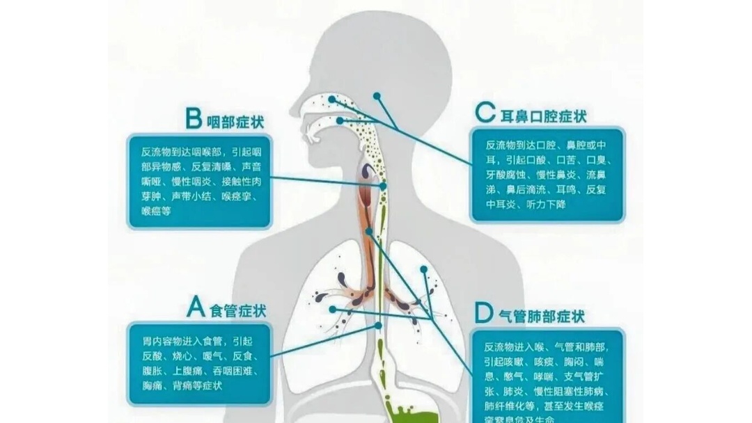 盐巴戟天的作用与功效-爱游戏官网